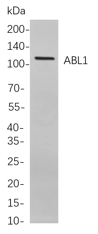ABL1 Rabbit Monoclonal Antibody - Size: 50µL