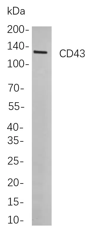 CD43 Rabbit Monoclonal Antibody - Size: 200µL