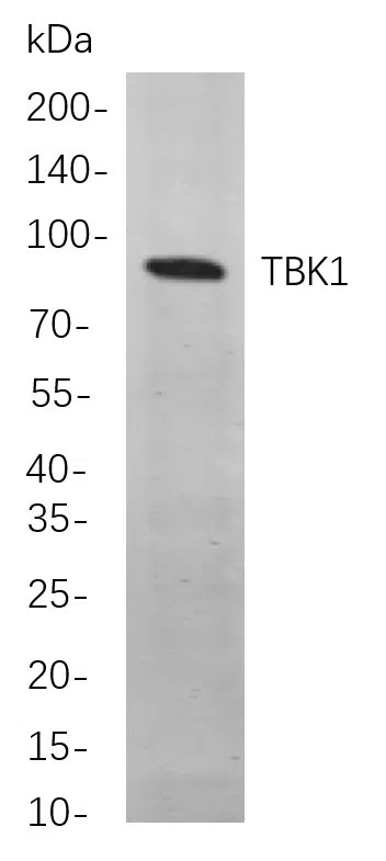 TBK1 Rabbit Monoclonal Antibody - Size: 100µL