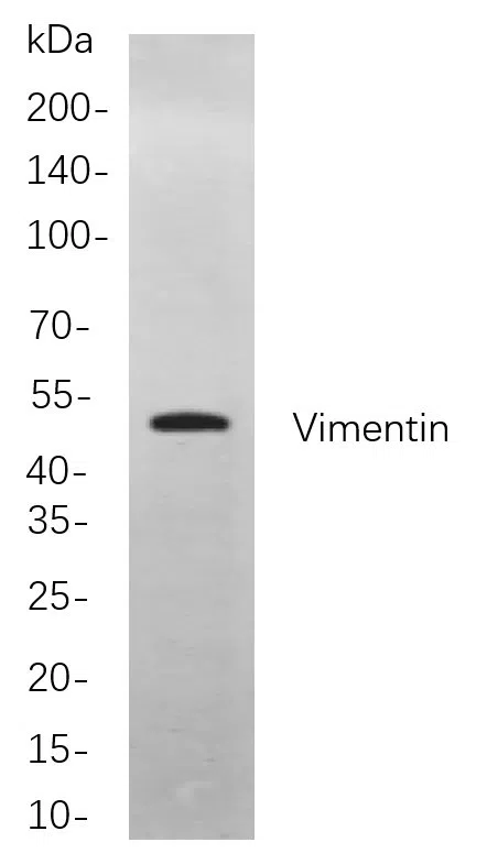 Vimentin Rabbit Monoclonal Antibody - Size: 100µL