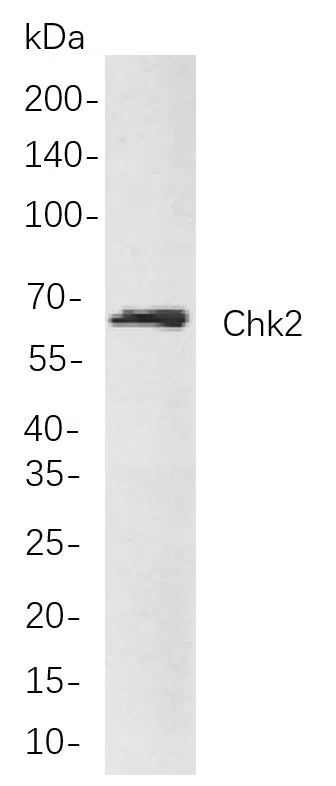 Chk2 Rabbit Monoclonal Antibody - Size: 100µL