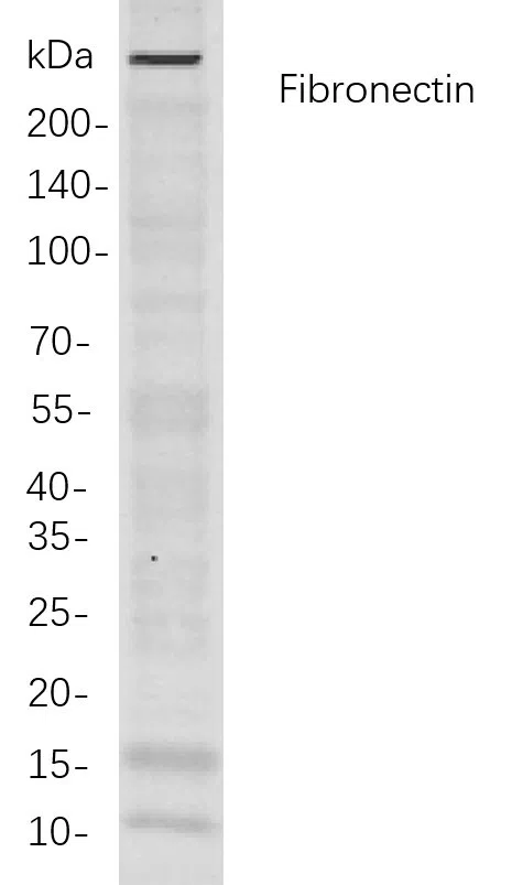 Fibronectin Rabbit Monoclonal Antibody - Size: 50µL