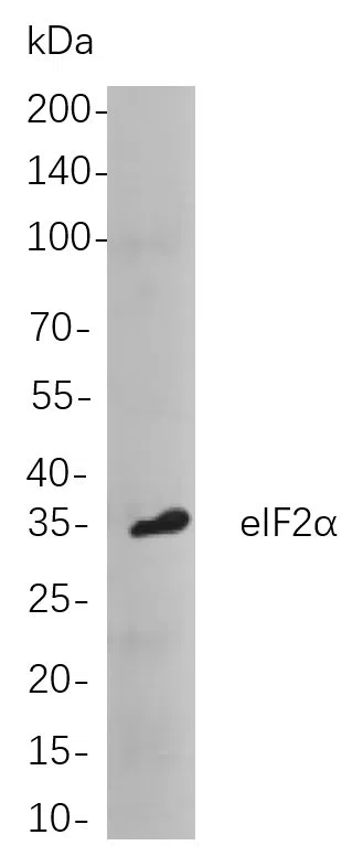 eIF2a Rabbit Monoclonal Antibody - Size: 200µL