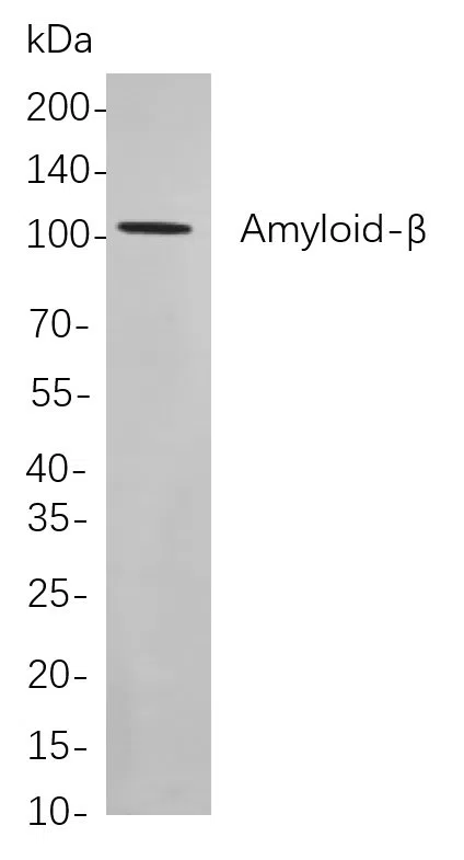 Amyloid-ß Rabbit Monoclonal Antibody - Size: 200µL