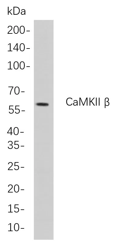 CaMKII ß Rabbit Monoclonal Antibody - Size: 100µL