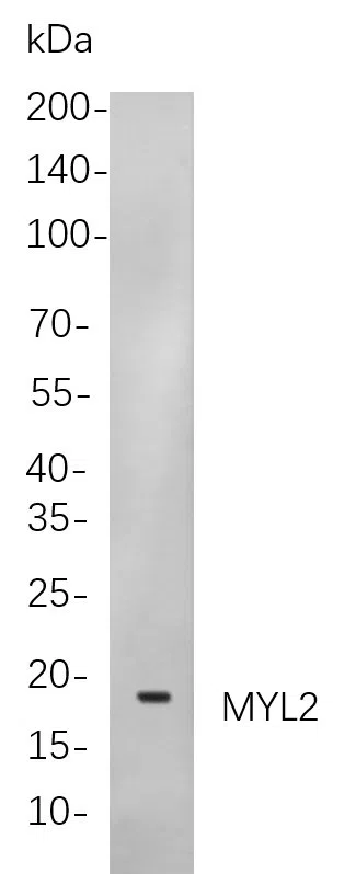 Myosin Light Chain 2 Rabbit Monoclonal Antibody - Size: 100µL
