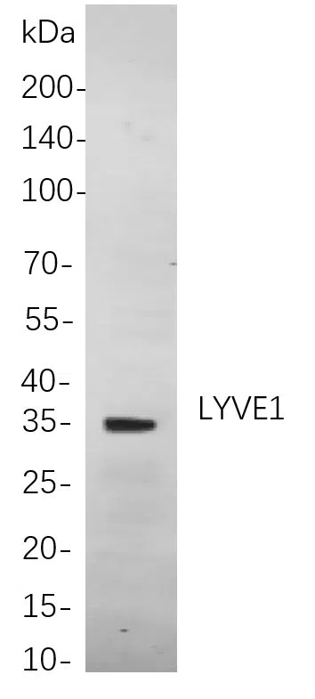 LYVE1 Rabbit Monoclonal Antibody - Size: 200µL