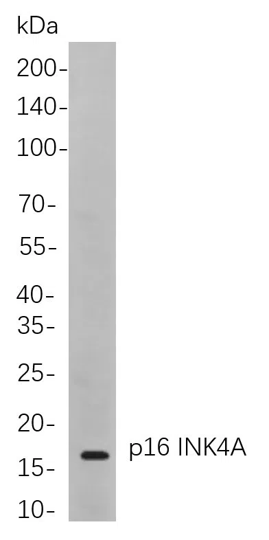 p16 INK4A Rabbit Monoclonal Antibody - Size: 100µL