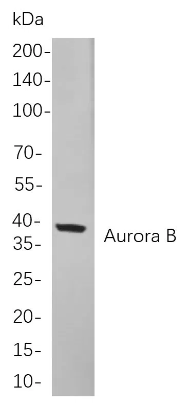 Aurora B Rabbit Monoclonal Antibody - Size: 200µL