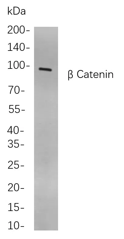 ß Catenin Rabbit Monoclonal Antibody - Size: 100µL