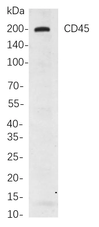 CD45 Rabbit Monoclonal Antibody