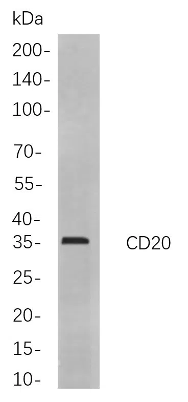 CD20 Rabbit Monoclonal Antibody