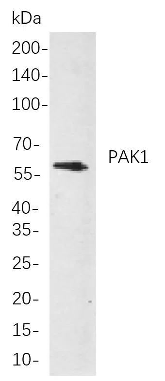 PAK1 Rabbit Monoclonal Antibody - Size: 100µL