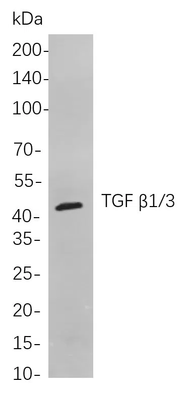 TGF ß1/3 Rabbit Monoclonal Antibody - Size: 100µL