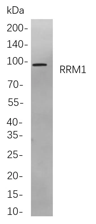 RRM1 Rabbit Monoclonal Antibody