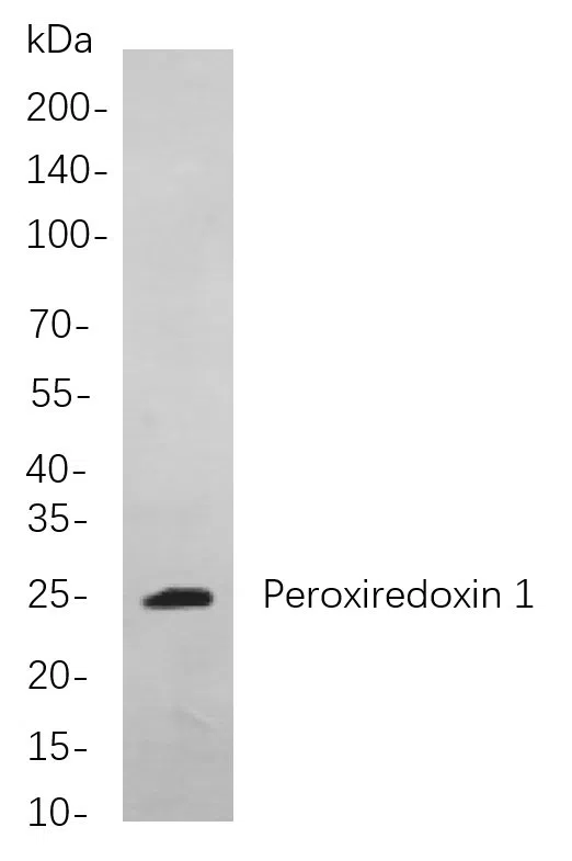 Peroxiredoxin 1 Rabbit Monoclonal Antibody