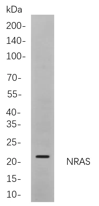 NRAS Rabbit Monoclonal Antibody