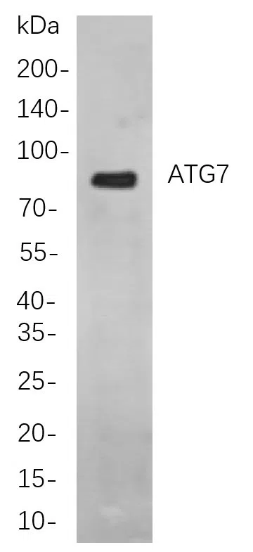 ATG7 Rabbit Monoclonal Antibody - Size: 100µL