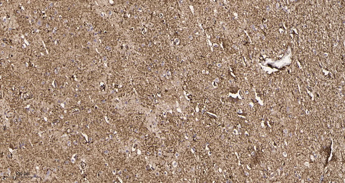 GFAP Rabbit Monoclonal Antibody