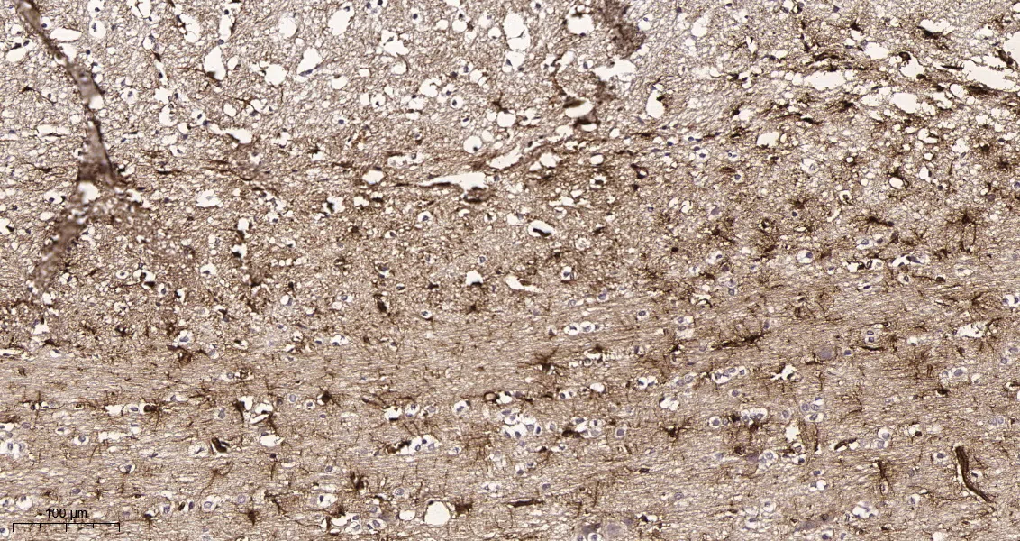 GFAP Rabbit Monoclonal Antibody