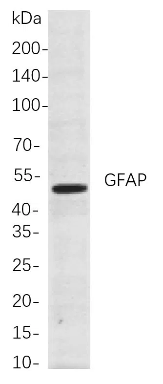 GFAP Rabbit Monoclonal Antibody