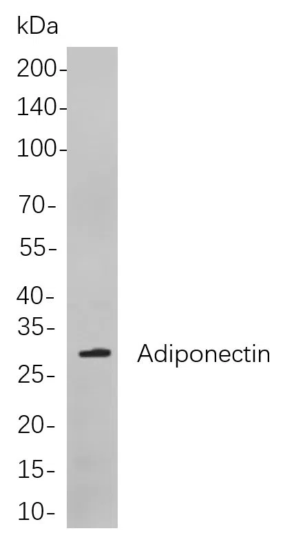 Adiponectin Rabbit Monoclonal Antibody - Size: 50µL
