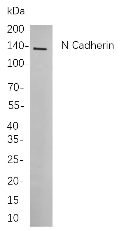 N Cadherin Rabbit Monoclonal Antibody - Size: 200µL