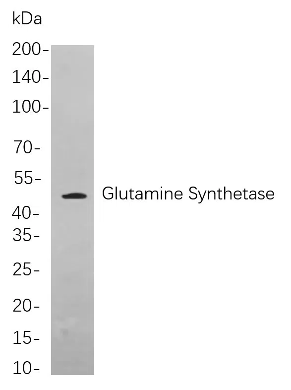 Glutamine Synthetase Rabbit Monoclonal Antibody - Size: 200µL