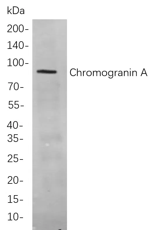 Chromogranin A Rabbit Monoclonal Antibody - Size: 100µL