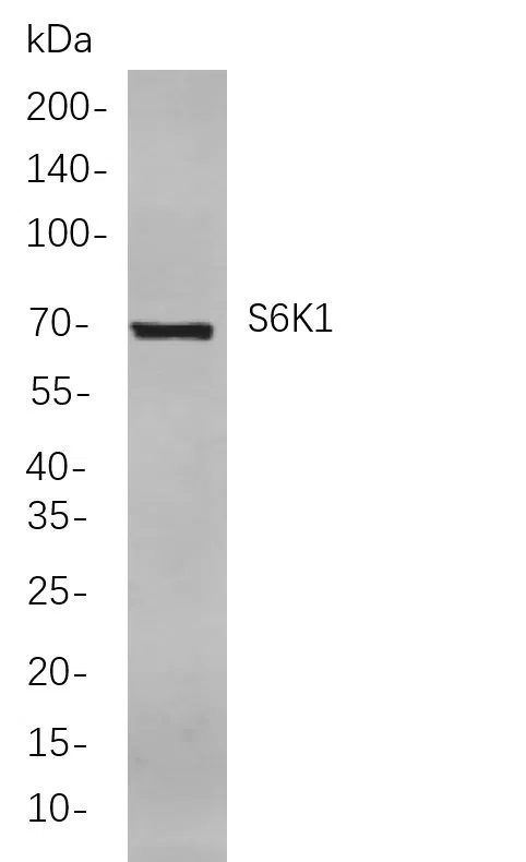 S6K1 Rabbit Monoclonal Antibody - Size: 100µL
