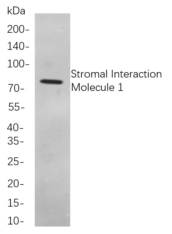 Stromal Interaction MolecµLe 1 Rabbit Monoclonal Antibody - Size: 200µL