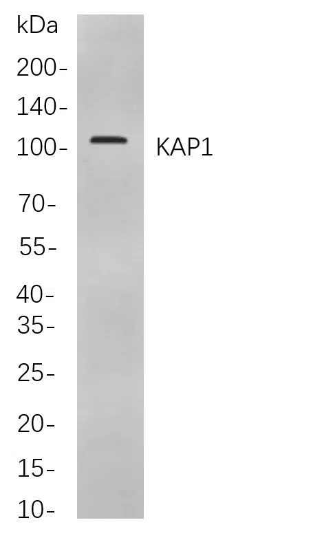 KAP1 Rabbit Monoclonal Antibody - Size: 100µL