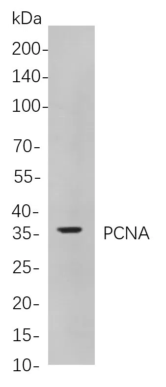 PCNA Rabbit Monoclonal Antibody - Size: 200µL