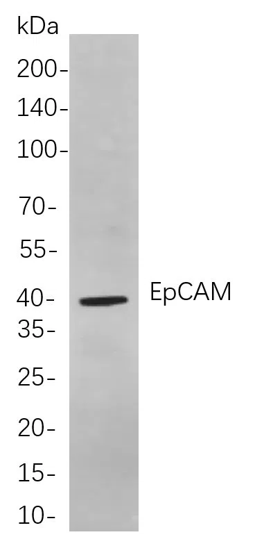 EpCAM Rabbit Monoclonal Antibody - Size: 50µL