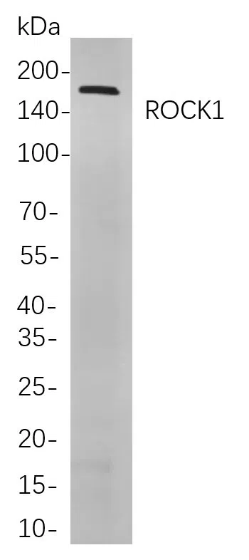 ROCK1 Rabbit Monoclonal Antibody - Size: 100µL
