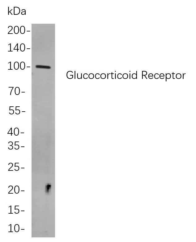 Glucocorticoid Receptor Rabbit Monoclonal Antibody - Size: 50µL