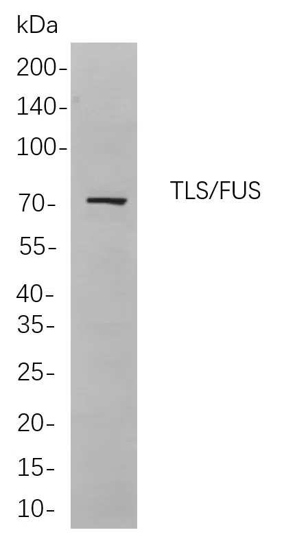 TLS/FUS Rabbit Monoclonal Antibody - Size: 200µL