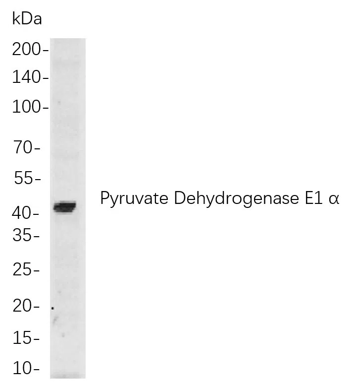 Pyruvate Dehydrogenase E1 a Rabbit Monoclonal Antibody - Size: 100µL