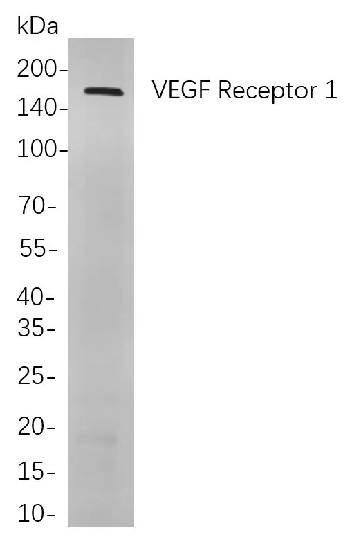 VEGF Receptor 1 Rabbit Monoclonal Antibody - Size: 200µL