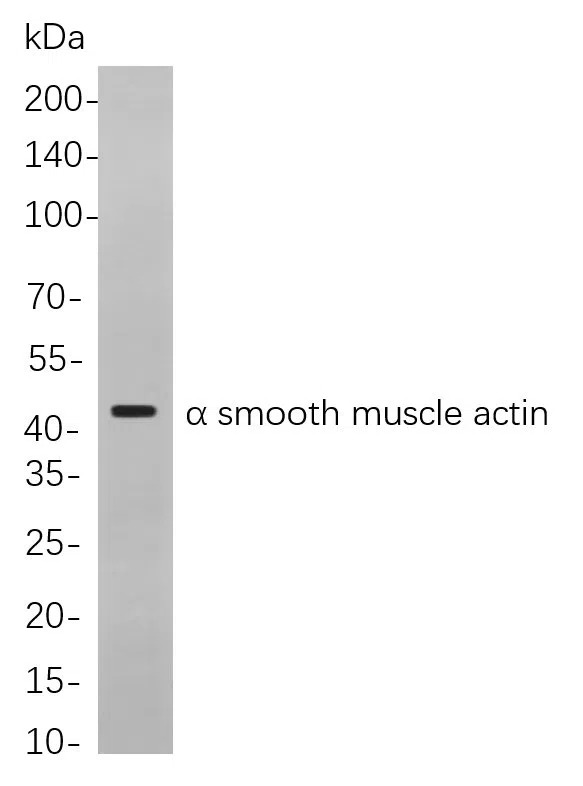 a smooth muscle actin Rabbit Monoclonal Antibody - Size: 50µL