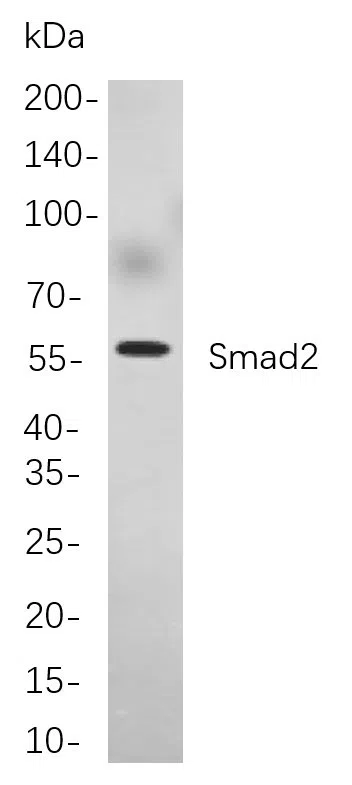 Smad2 Rabbit Monoclonal Antibody - Size: 50µL