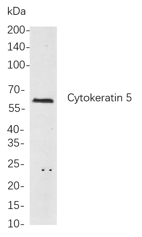 Cytokeratin 5 Rabbit Monoclonal Antibody - Size: 100µL