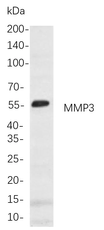 MMP3 Rabbit Monoclonal Antibody - Size: 100µL