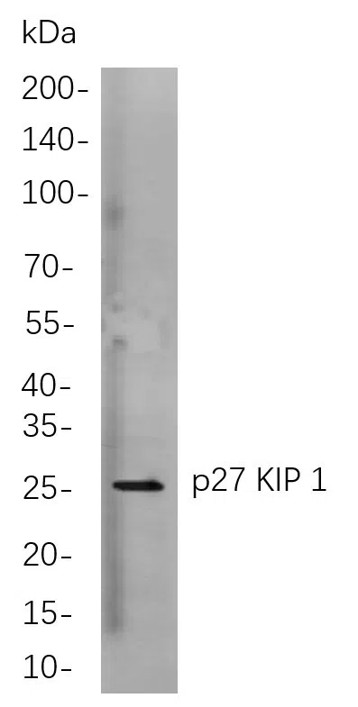 p27 KIP 1 Rabbit Monoclonal Antibody - Size: 50µL