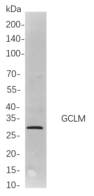 GCLM Rabbit Monoclonal Antibody - Size: 100µL