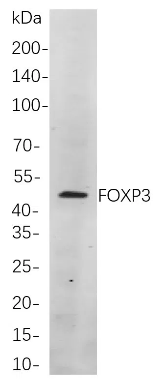 FOXP3 Rabbit Monoclonal Antibody - Size: 200µL