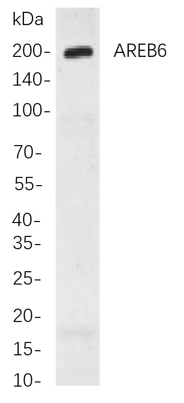 AREB6 Rabbit Monoclonal Antibody - Size: 50µL