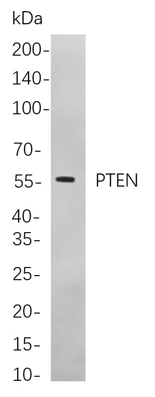 PTEN Rabbit Monoclonal Antibody - Size: 50µL