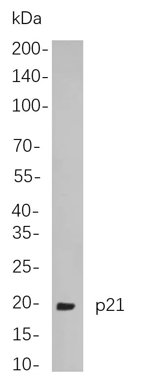 p21 Rabbit Monoclonal Antibody - Size: 50µL