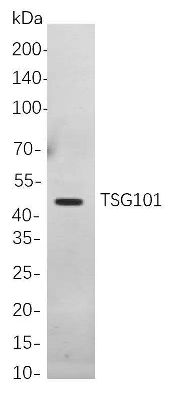 TSG101 Rabbit Monoclonal Antibody - Size: 50µL